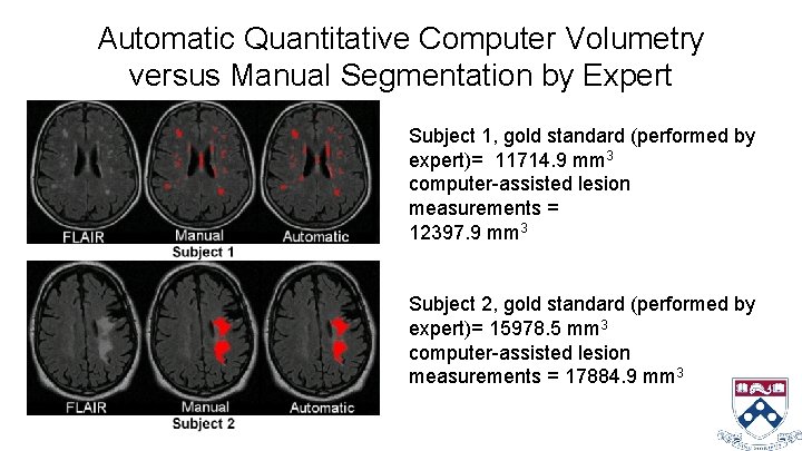 Automatic Quantitative Computer Volumetry versus Manual Segmentation by Expert Subject 1, gold standard (performed
