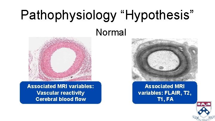 Pathophysiology “Hypothesis” Normal Associated MRI variables: Vascular reactivity Cerebral blood flow Associated MRI variables:
