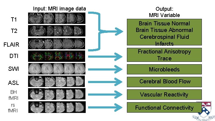 Input: MRI image data T 1 Output: MRI Variable DTI Brain Tissue Normal Brain
