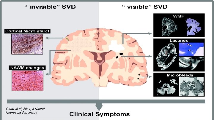 Gouw et al, 2011, J Neurol Neurosurg Psychiatry 