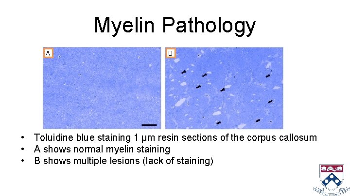 Myelin Pathology A B • Toluidine blue staining 1 μm resin sections of the