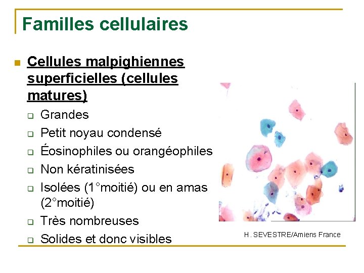 Familles cellulaires n Cellules malpighiennes superficielles (cellules matures) q q q q Grandes Petit