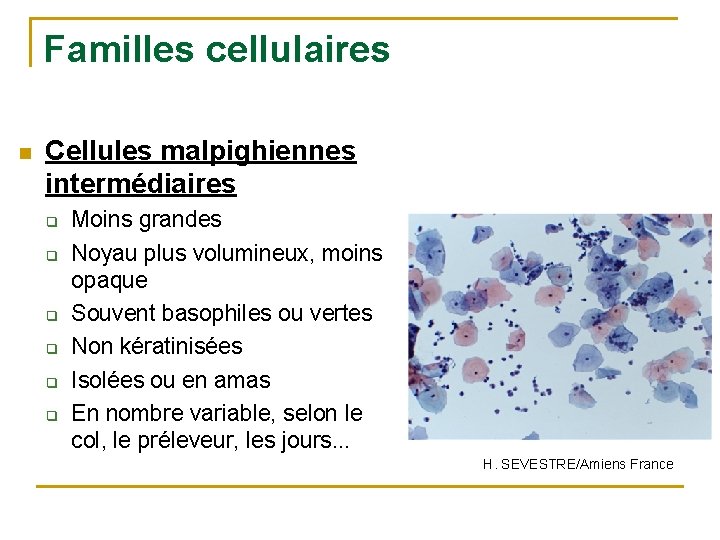 Familles cellulaires n Cellules malpighiennes intermédiaires q q q Moins grandes Noyau plus volumineux,