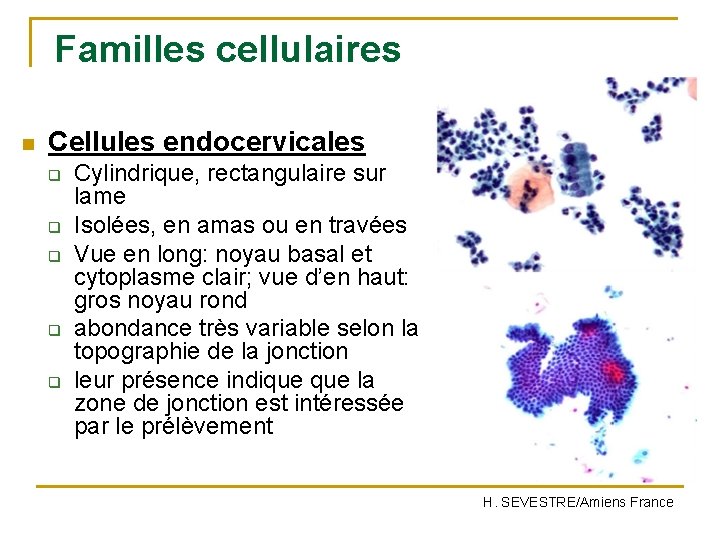 Familles cellulaires n Cellules endocervicales q q q Cylindrique, rectangulaire sur lame Isolées, en