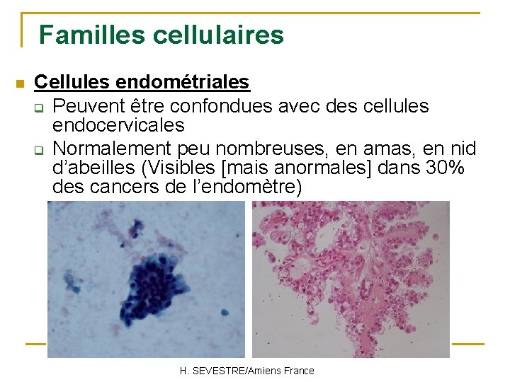 Familles cellulaires n Cellules endométriales q Peuvent être confondues avec des cellules endocervicales q