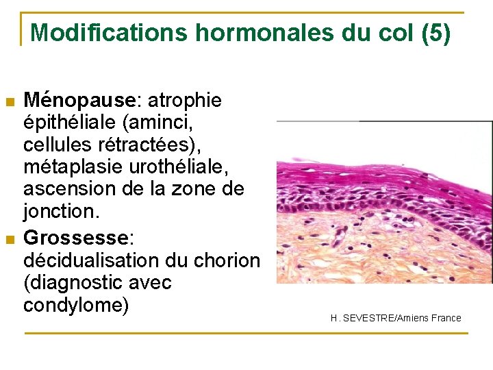 Modifications hormonales du col (5) n n Ménopause: atrophie épithéliale (aminci, cellules rétractées), métaplasie