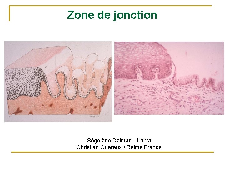 Zone de jonction Ségolène Delmas‐Lanta Christian Quereux / Reims France 