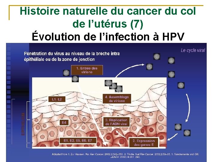 Histoire naturelle du cancer du col de l’utérus (7) Évolution de l’infection à HPV