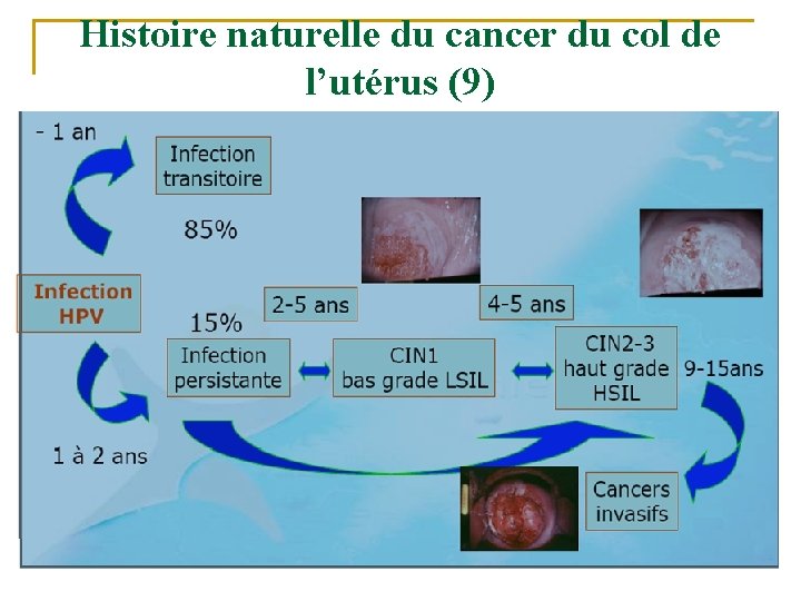 Histoire naturelle du cancer du col de l’utérus (9) 