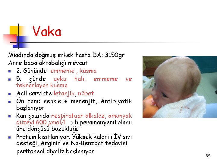 Vaka Miadında doğmuş erkek hasta DA: 3150 gr Anne baba akrabalığı mevcut 2. Gününde