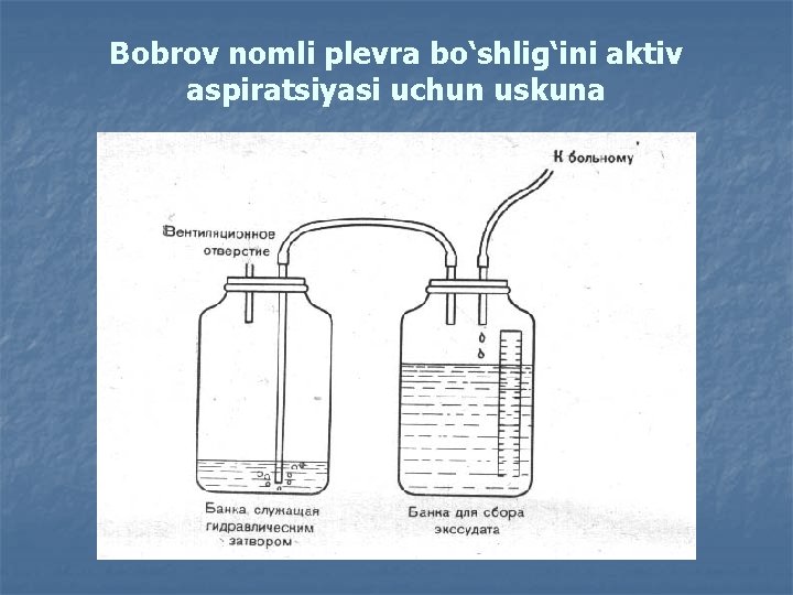 Bobrov nomli plevra bo‘shlig‘ini aktiv aspiratsiyasi uchun uskuna 