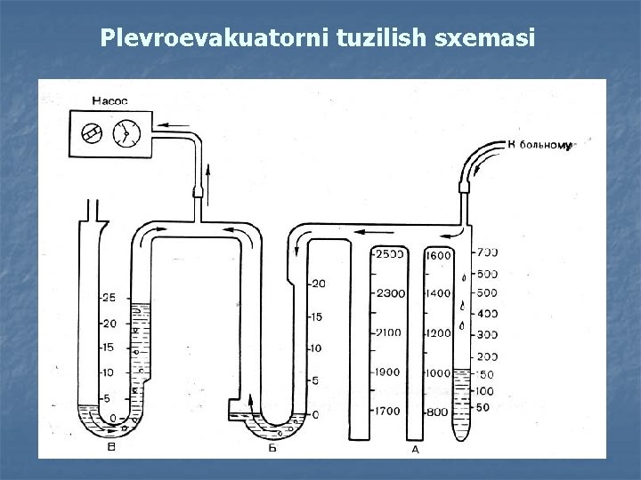 Plevroevakuatorni tuzilish sxemasi 