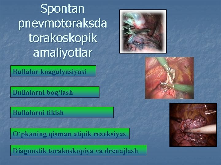 Spontan pnevmotoraksda torakoskopik amaliyotlar Bullalar koagulyasi Bullalarni bog‘lash Bullalarni tikish O‘pkaning qisman atipik rezeksiyas