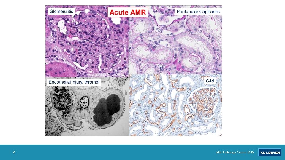 6 ASN Pathology Course 2019 