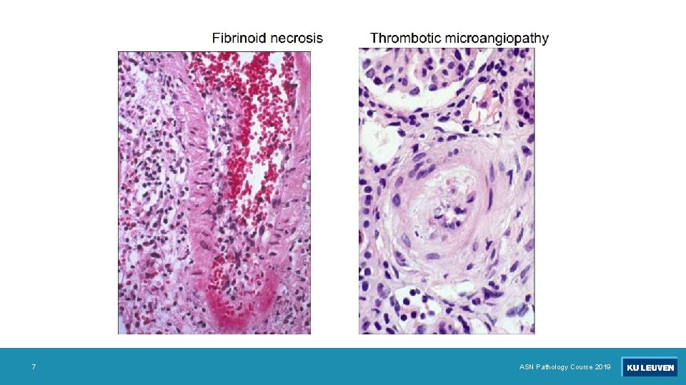 7 ASN Pathology Course 2019 