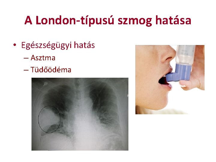 A London-típusú szmog hatása • Egészségügyi hatás – Asztma – Tüdőödéma 