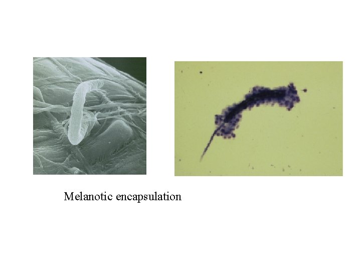 Melanotic encapsulation 