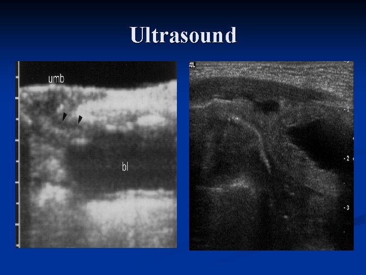 Ultrasound 