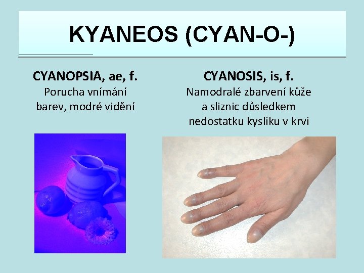 KYANEOS (CYAN-O-) CYANOPSIA, ae, f. Porucha vnímání barev, modré vidění CYANOSIS, is, f. Namodralé