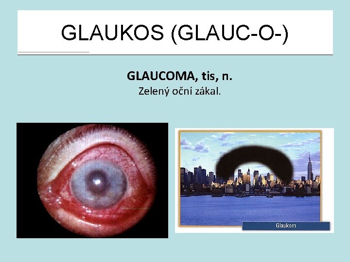 GLAUKOS (GLAUC-O-) GLAUCOMA, tis, n. Zelený oční zákal. 