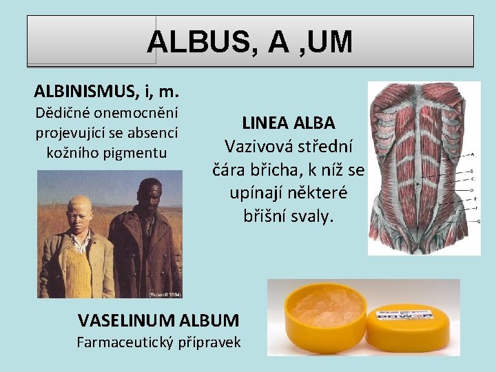 ALBUS, A , UM ALBINISMUS, i, m. Dědičné onemocnění projevující se absencí kožního pigmentu