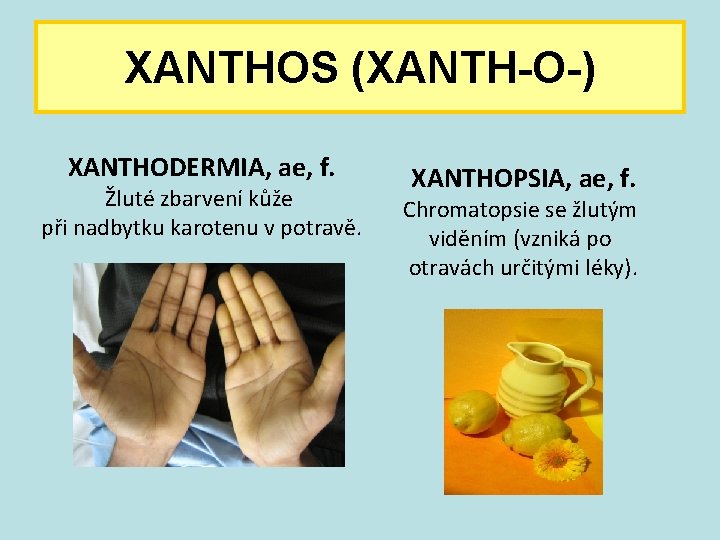 XANTHOS (XANTH-O-) XANTHODERMIA, ae, f. Žluté zbarvení kůže při nadbytku karotenu v potravě. XANTHOPSIA,