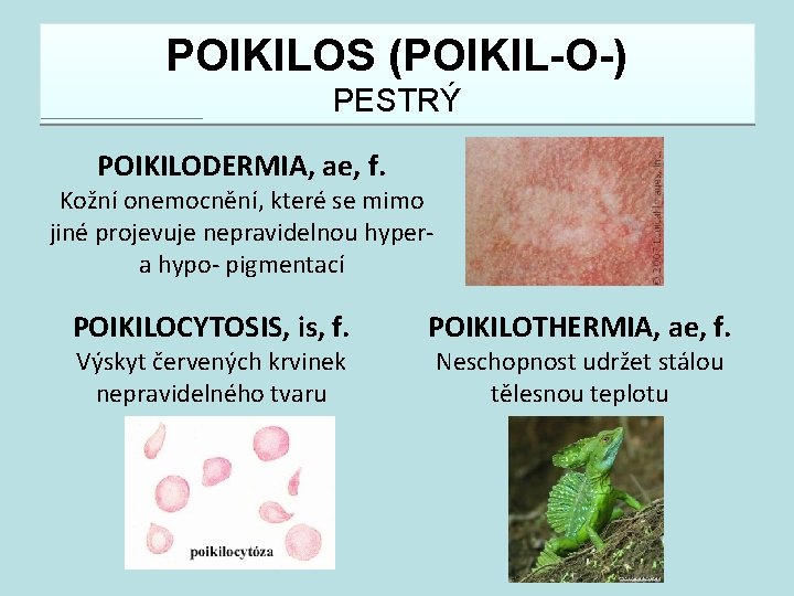 POIKILOS (POIKIL-O-) PESTRÝ POIKILODERMIA, ae, f. Kožní onemocnění, které se mimo jiné projevuje nepravidelnou