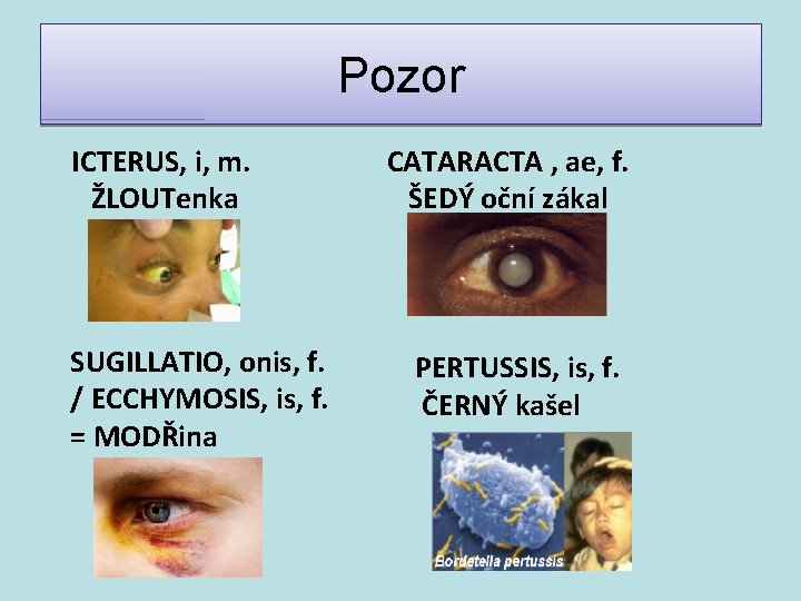 Pozor ICTERUS, i, m. ŽLOUTenka SUGILLATIO, onis, f. / ECCHYMOSIS, is, f. = MODŘina