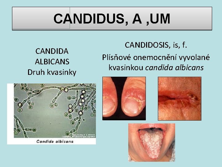 CANDIDUS, A , UM CANDIDA ALBICANS Druh kvasinky CANDIDOSIS, is, f. Plísňové onemocnění vyvolané