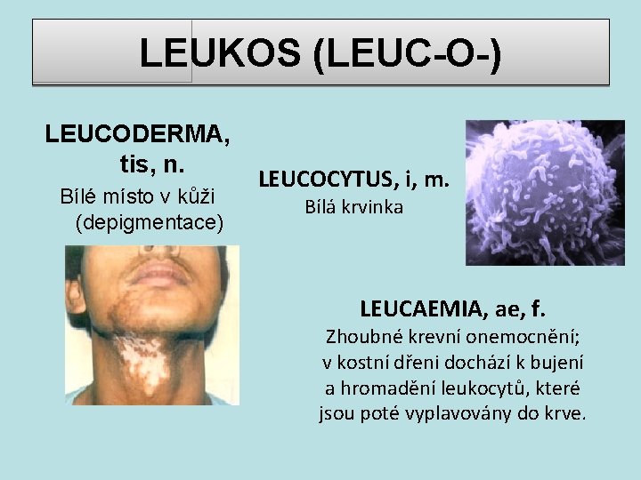 LEUKOS (LEUC-O-) LEUCODERMA, tis, n. Bílé místo v kůži (depigmentace) LEUCOCYTUS, i, m. Bílá