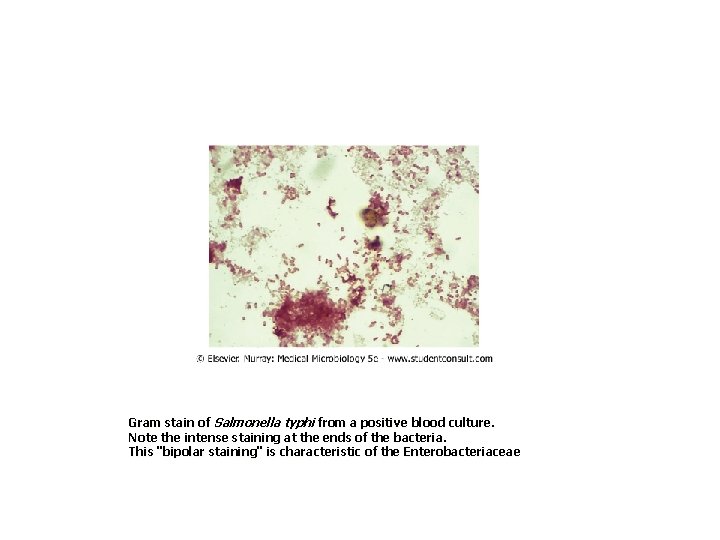Gram stain of Salmonella typhi from a positive blood culture. Note the intense staining Gram stain of Salmonella typhi from a positive blood culture. Note the intense staining