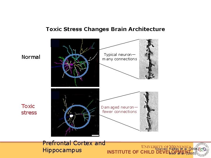Toxic Stress Changes Brain Architecture Normal Toxic stress Typical neuron— many connections Damaged neuron—