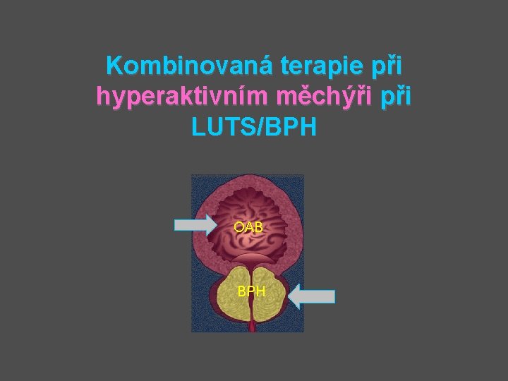 Kombinovaná terapie při hyperaktivním měchýři při LUTS/BPH OAB BPH 