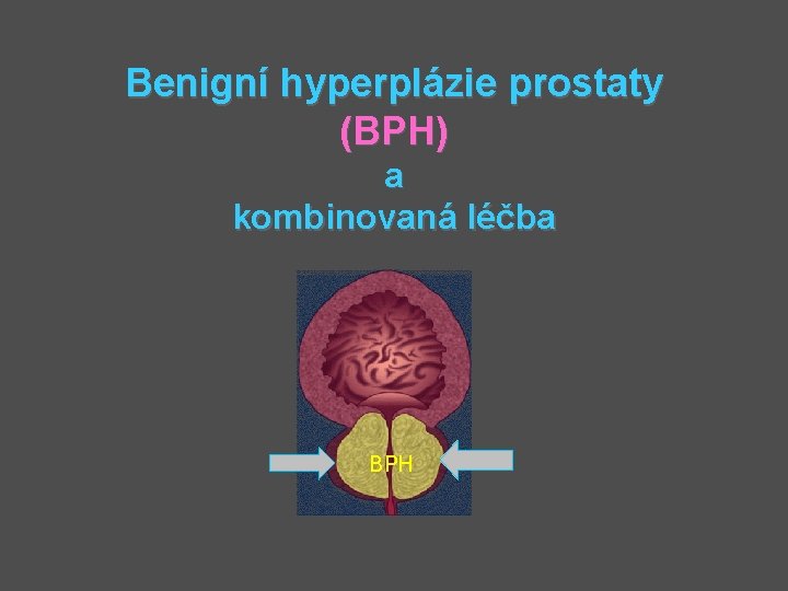 Benigní hyperplázie prostaty (BPH) a kombinovaná léčba BPH 