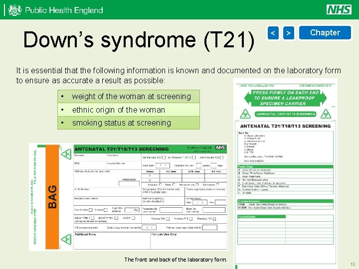  Down’s syndrome (T 21) < > Chapter It is essential that the following