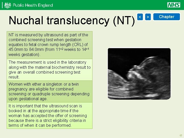 Nuchal translucency (NT) < > Chapter NT is measured by ultrasound as part of