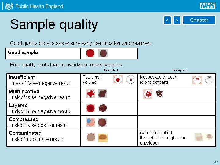 Sample quality < > Chapter Good quality blood spots ensure early identification and treatment.