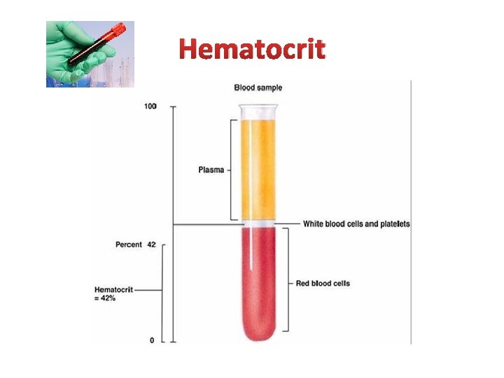 Hematocrit 