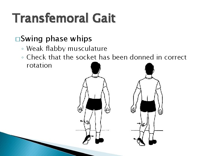 Transfemoral Gait � Swing phase whips ◦ Weak flabby musculature ◦ Check that the