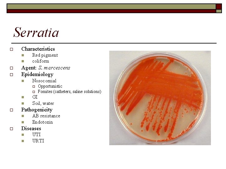 Serratia o Characteristics n n o o Red pigment coliform Agent: S. marcescens Epidemiology