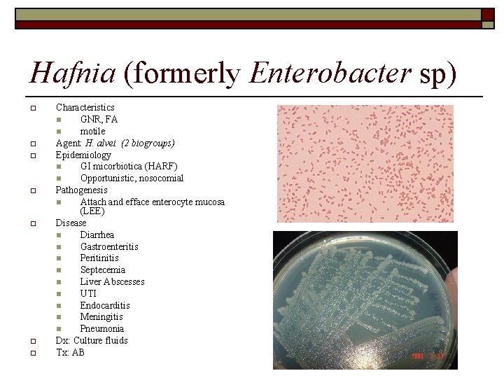 Hafnia (formerly Enterobacter sp) o o o o Characteristics n GNR, FA n motile