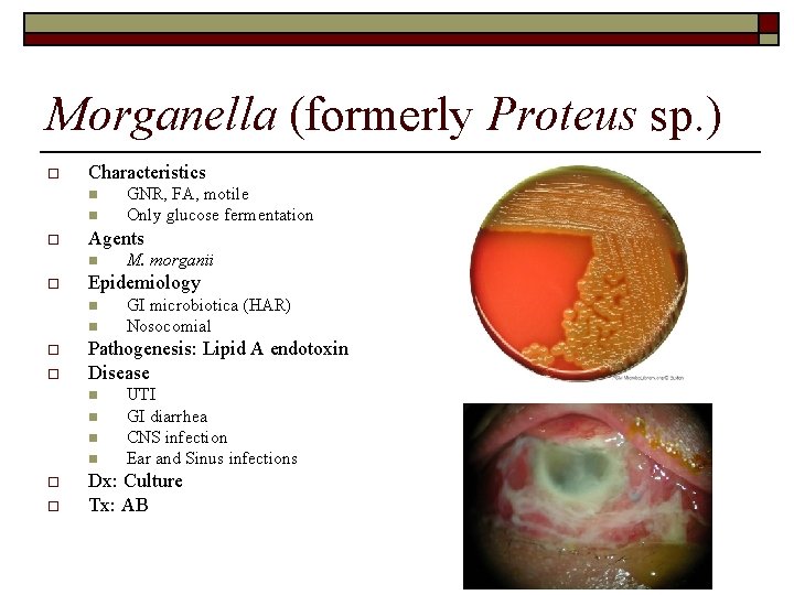 Morganella (formerly Proteus sp. ) o Characteristics n n o Agents n o n