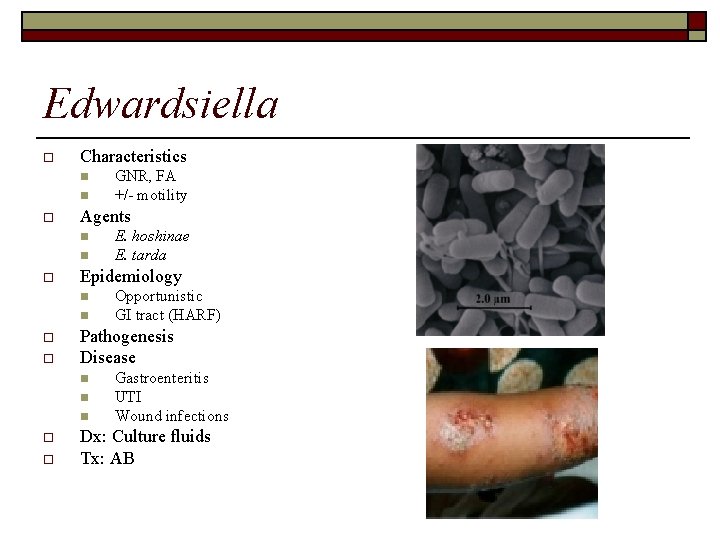 Edwardsiella o Characteristics n n o Agents n n o Opportunistic GI tract (HARF)
