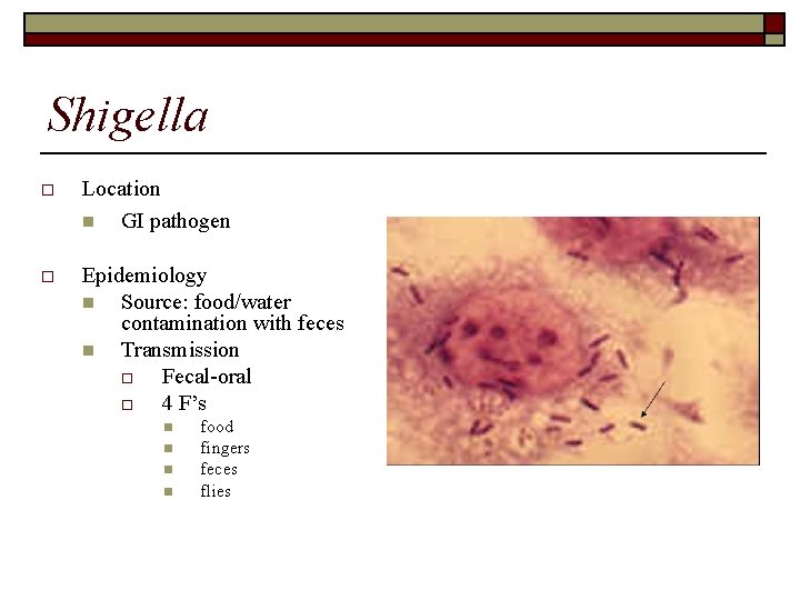 Shigella o Location n GI pathogen o Epidemiology n Source: food/water contamination with feces