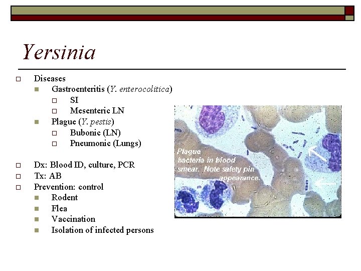 Yersinia o Diseases n Gastroenteritis (Y. enterocolitica) o SI o Mesenteric LN n Plague