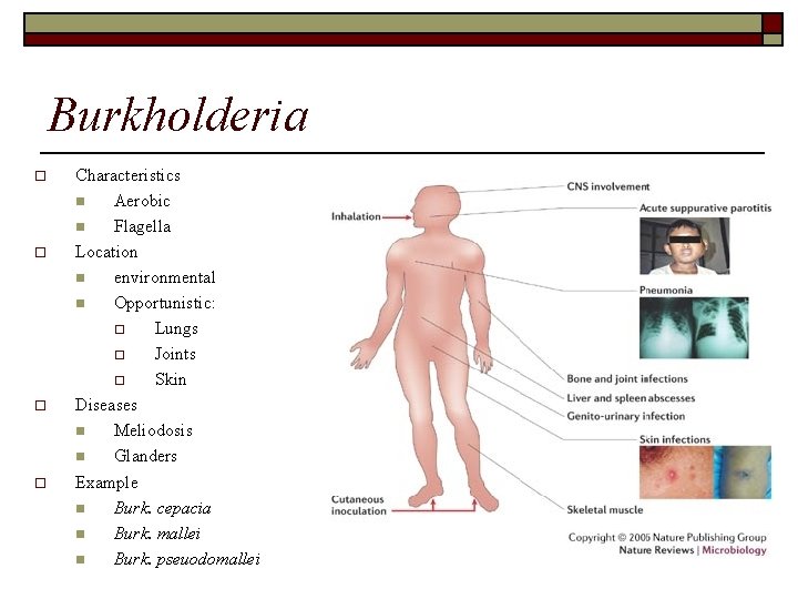 Burkholderia o o Characteristics n Aerobic n Flagella Location n environmental n Opportunistic: o