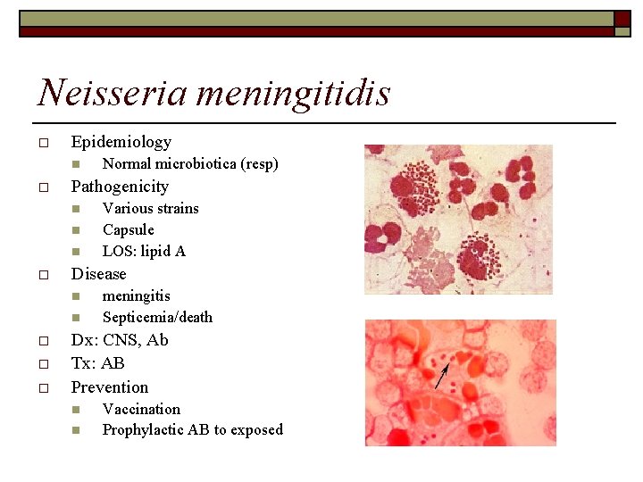 Neisseria meningitidis o Epidemiology n o Pathogenicity n n n o o Various strains