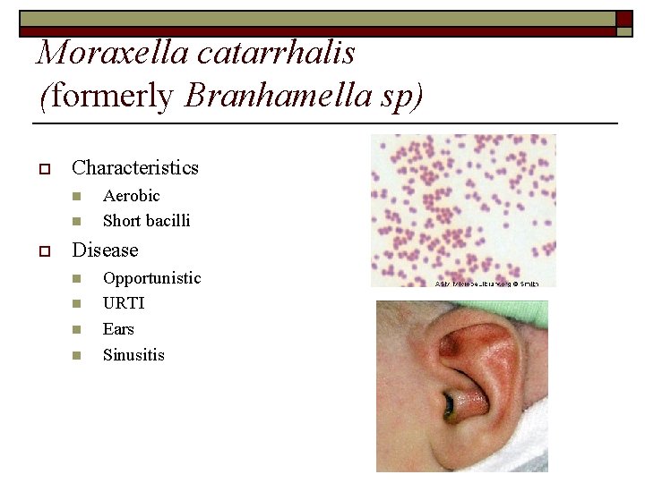 Moraxella catarrhalis (formerly Branhamella sp) o Characteristics n n o Aerobic Short bacilli Disease