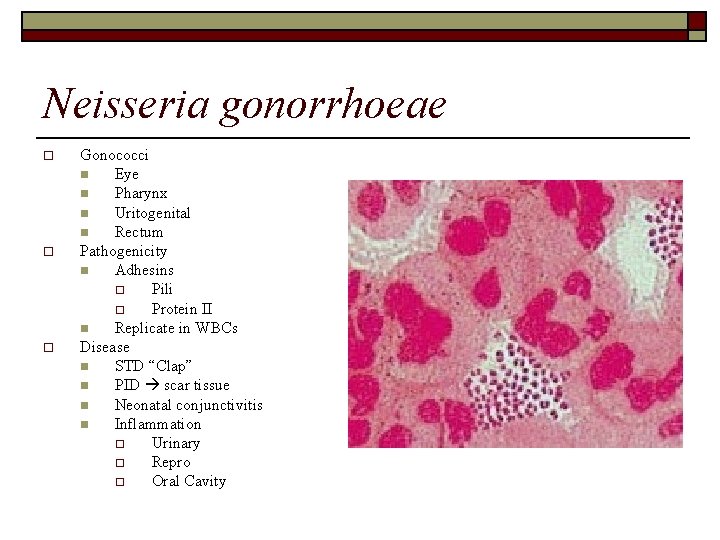 Neisseria gonorrhoeae o o o Gonococci n Eye n Pharynx n Uritogenital n Rectum