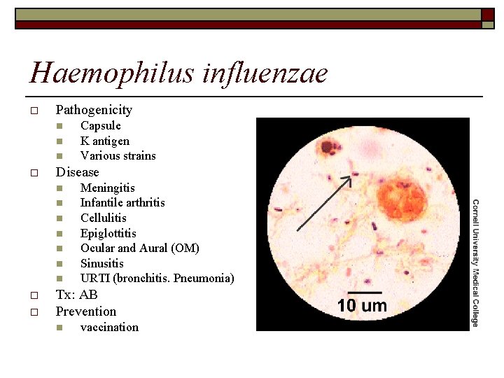 Haemophilus influenzae o Pathogenicity n n n o Disease n n n n o